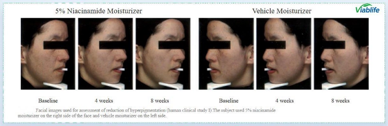 Νικοτιναμίδη για τη Λάμψη του Δέρματος Nicotinamide for Skin Brightening